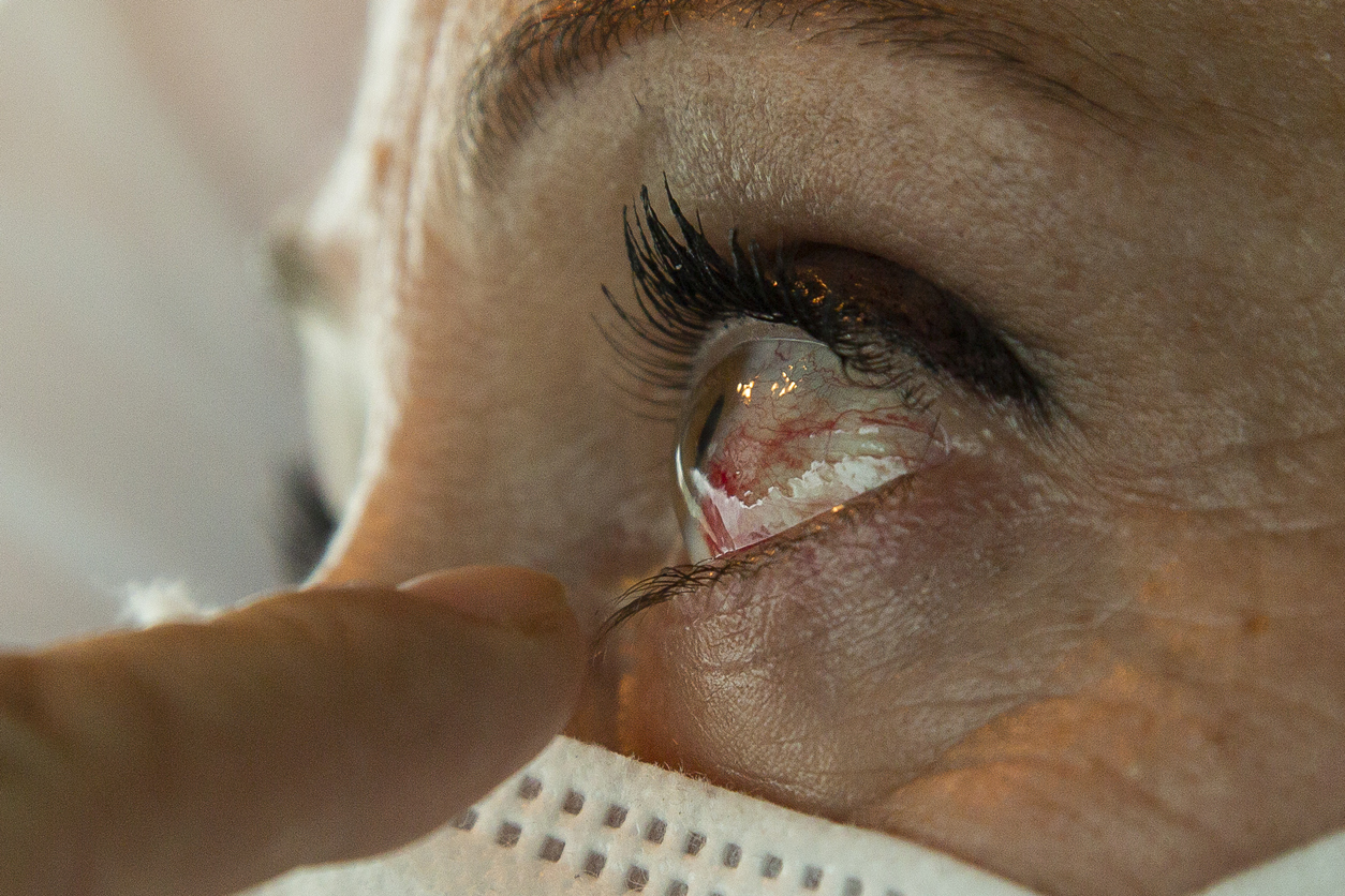 Sinais de deslocamento da retina: É importante dizer que o processo é indolor – iStock/Getty Images