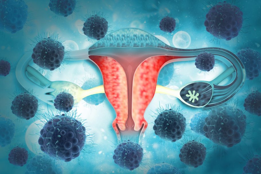 Tumor cervical pode ser prevenido com o exame de Papanicolau