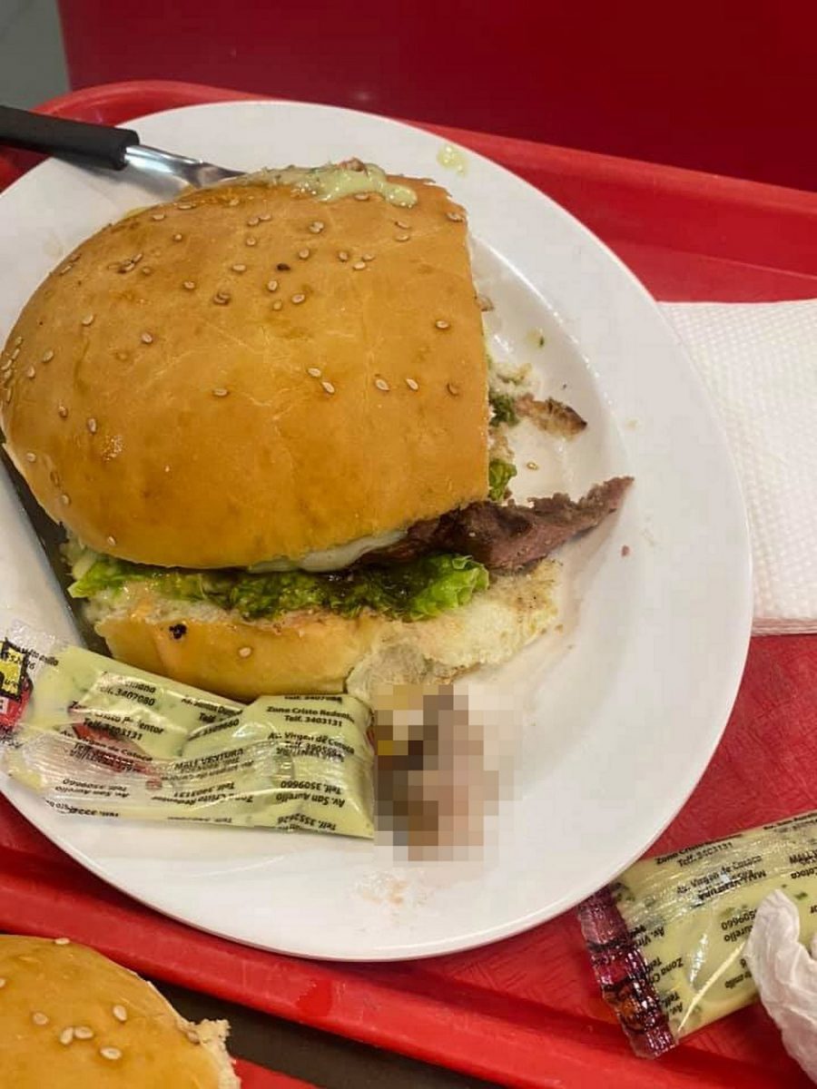 Mulher encontra dedo podre em seu hambúrguer na Bolívia