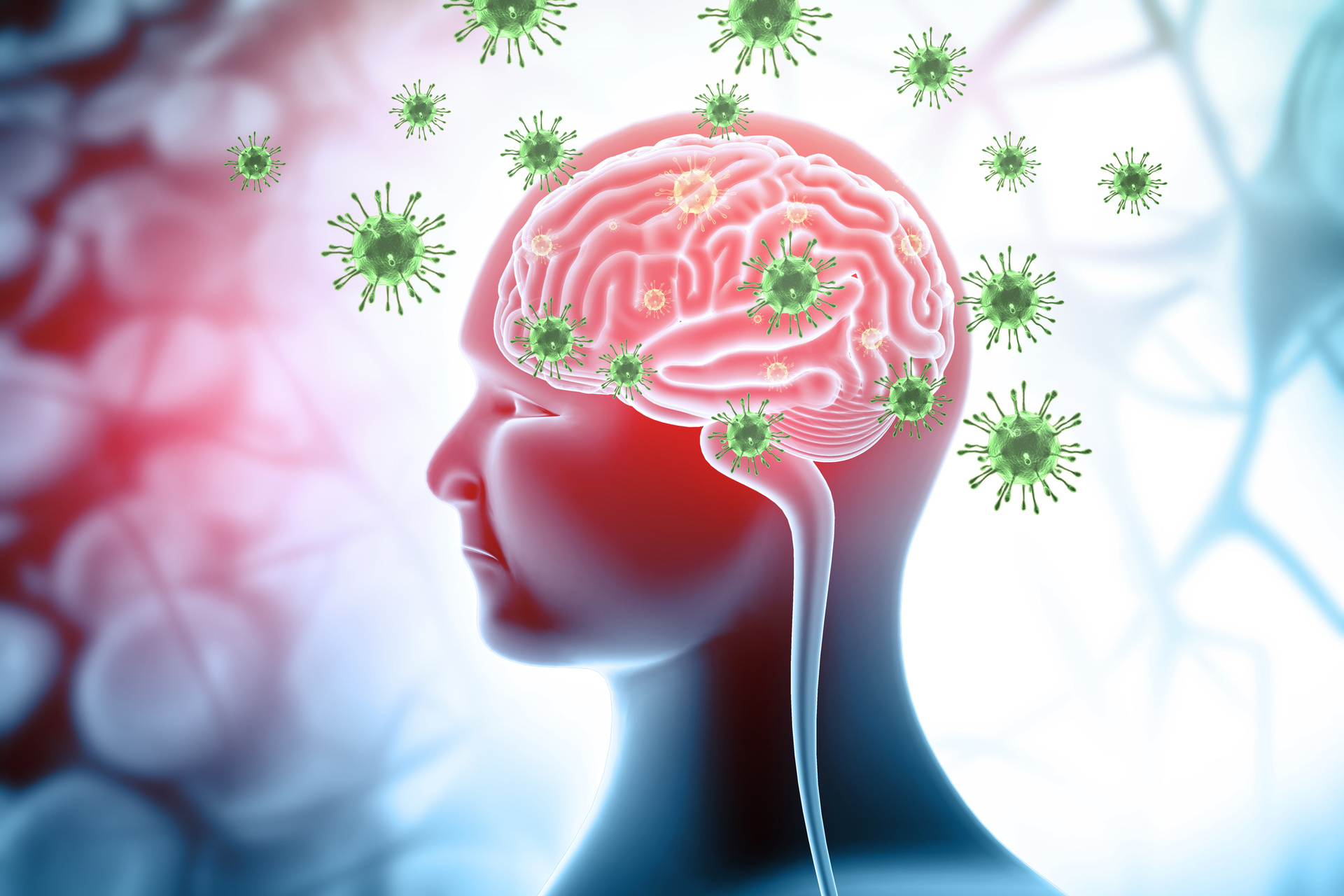 O vírus Nipahencefalite pode causar inchaço no cérebro, que pode evoluir para convulsões e morte