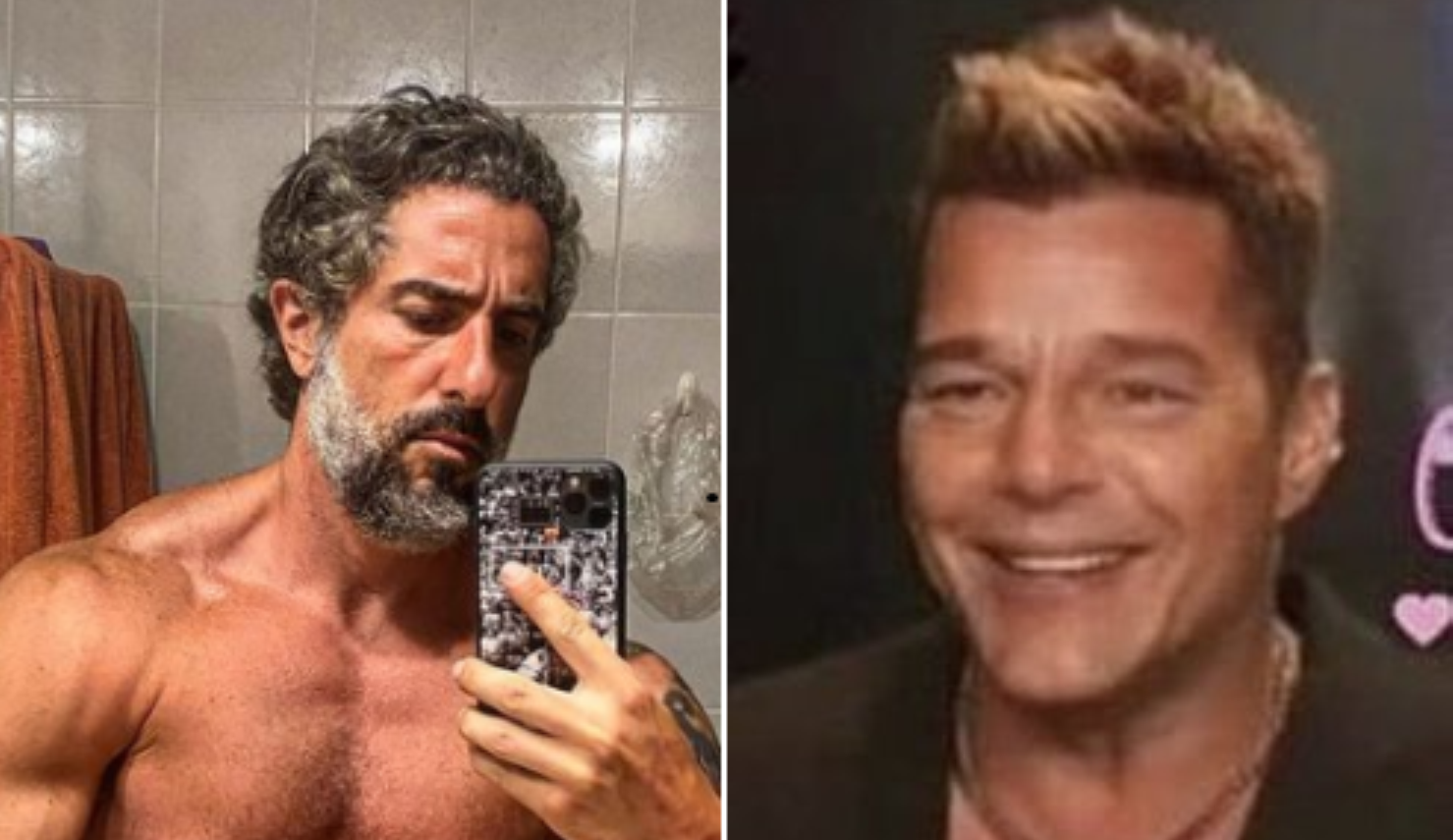 Marcos Mion critica harmonização facial de Ricky Martin, mas tudo não passava de alergia