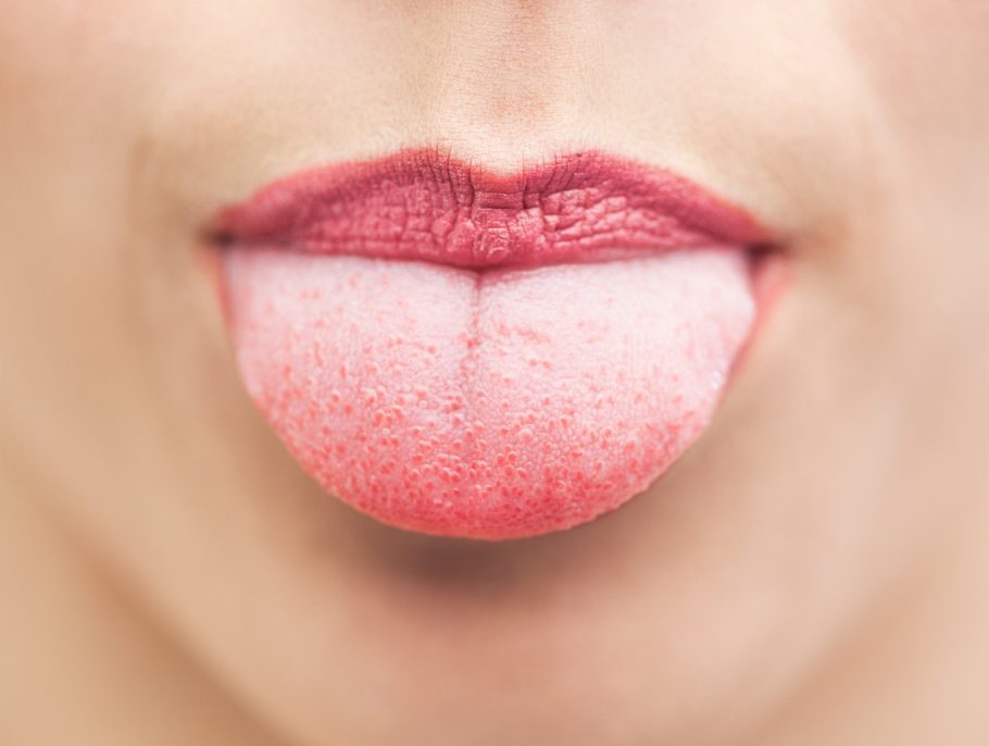 A maioria dos problemas de saúde na língua envolve má higiene ou imunidade baixa