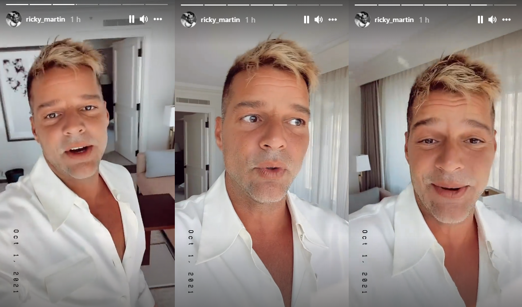 Ricky Martin nega que tenha feito qualquer intervenção no rosto e culpa reação alérgica