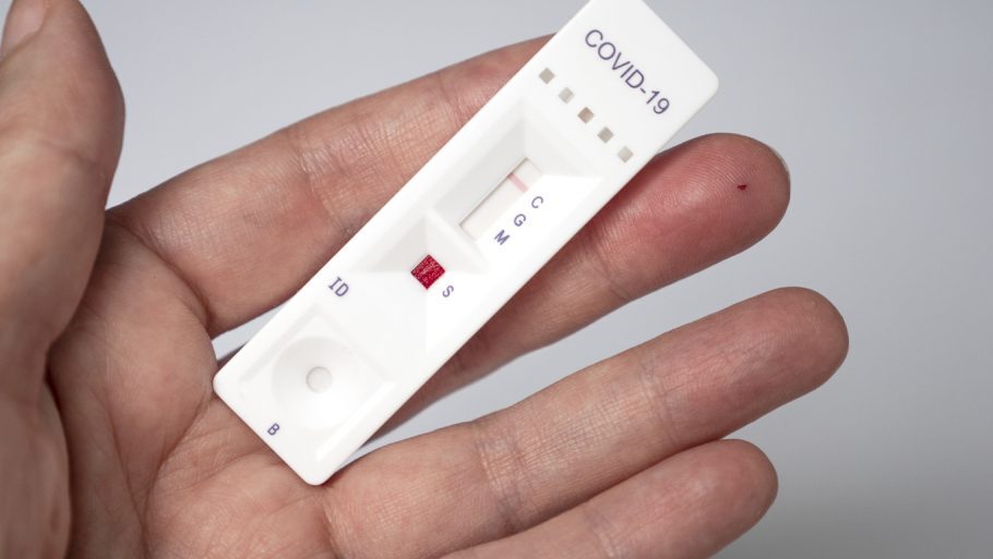 Médico alerta para falsos resultados dos testes de anticorpos de covid-19 e diz que é “jogar dinheiro fora”