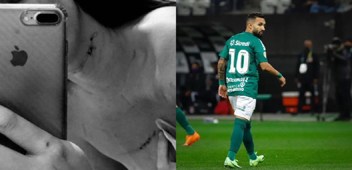 Mulher que denunciou jogador do Cuiabá por agressão posta foto com ferimentos