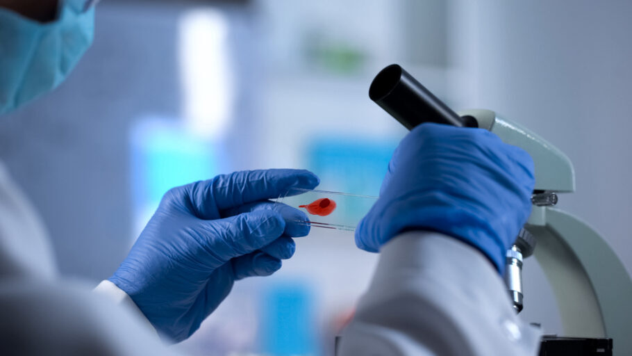 Análises das amostras de sangue não apontam sinais da infecção por HIV