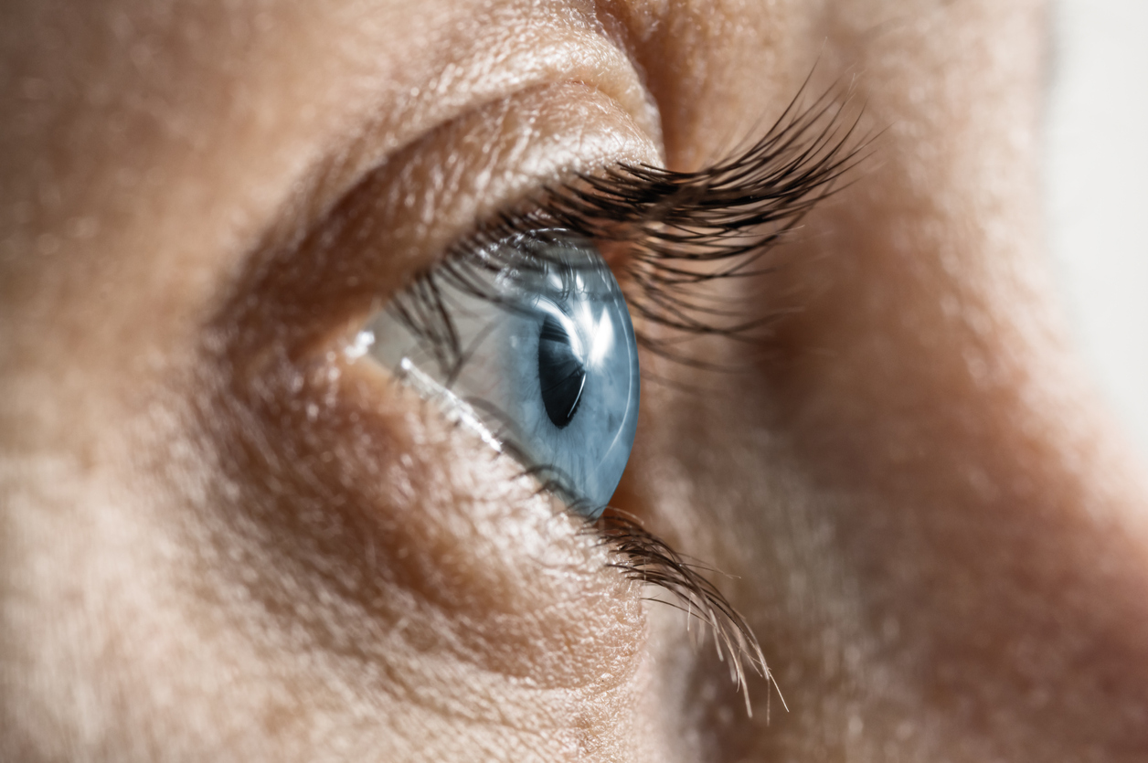 Understand why cataracts are more common in women