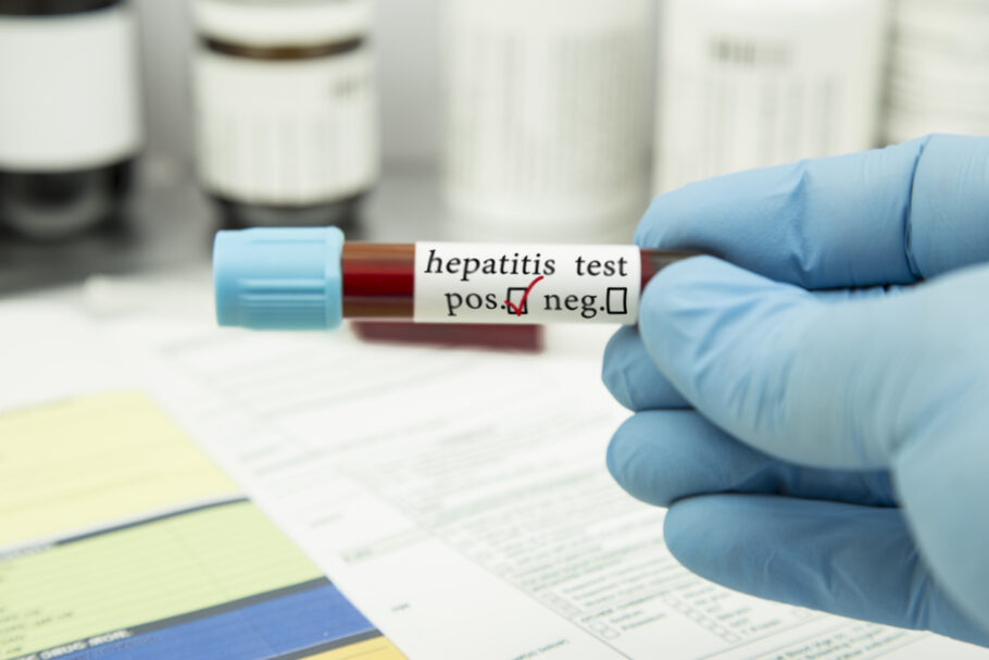 casos de hepatite misteriosa continuam a surgir