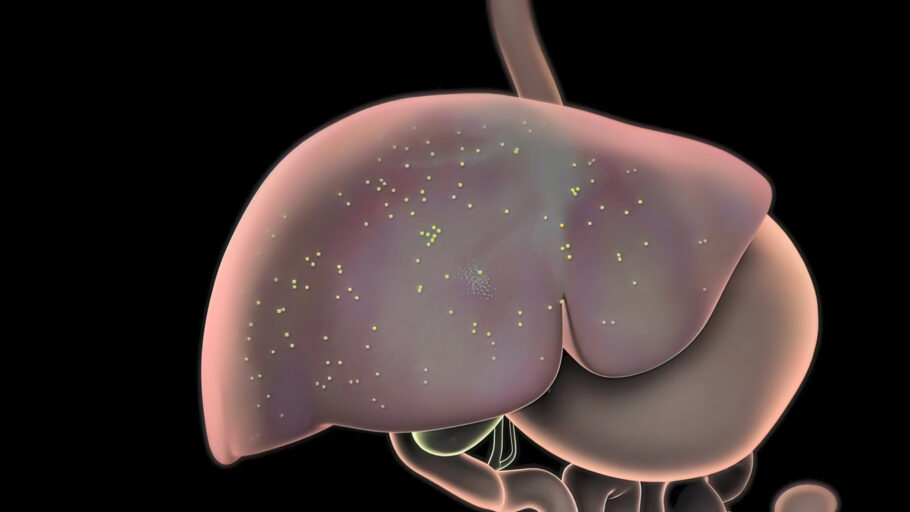 Urina escura e icterícia são alguns dos sinais de hepatite misteriosa