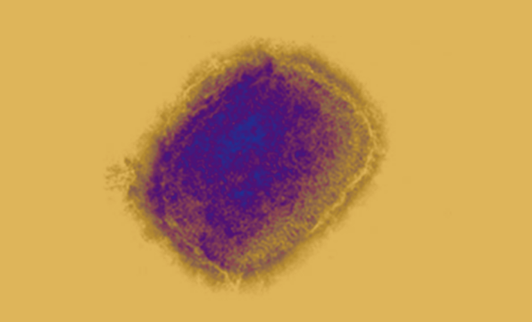 varíola dos macacos