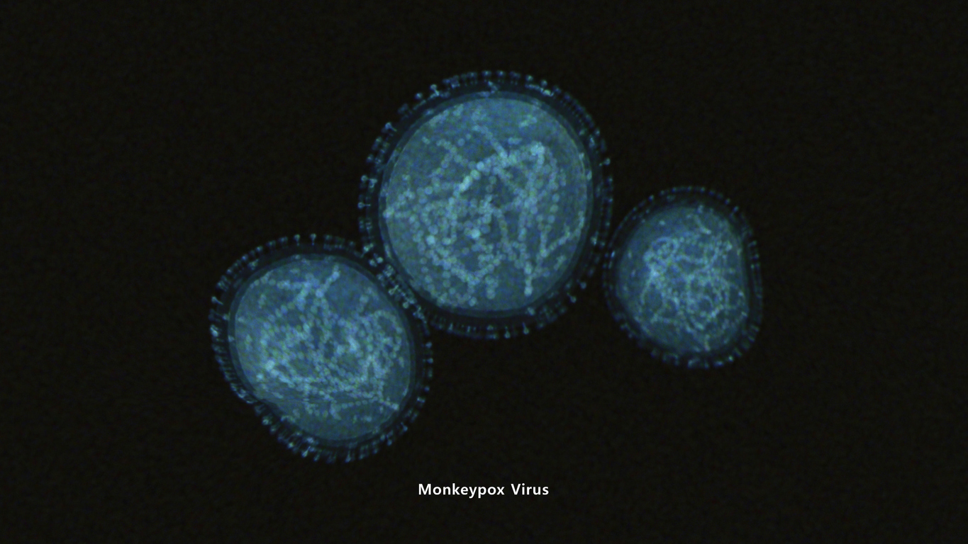 O vírus da varíola dos macacos está relacionado ao vírus da varíola