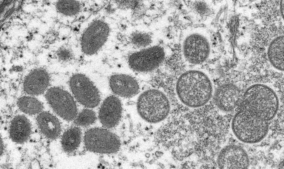 Brasil tem terceiro caso confirmado de varíola do macaco