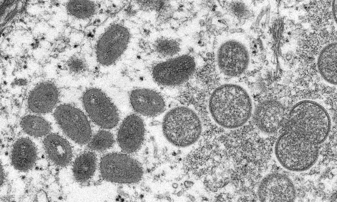 São Paulo confirmou casos de varíola do macaco