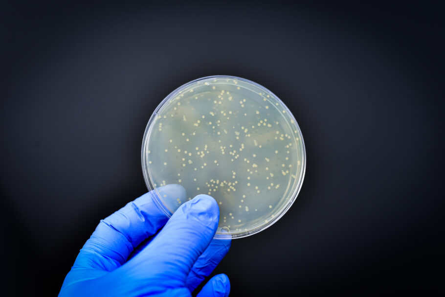 Pelo menos uma pessoa morreu contaminada com bactéria listeria nos EUA