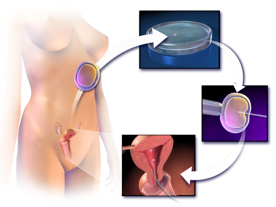 Representação da tecnologia de fertilização in vitro