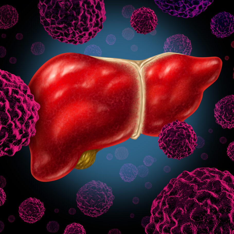 Hormônio de células de gordura pode servir de terapêutica para o câncer de fígado