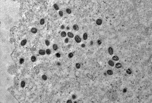 Partículas virais se replicam no interior da célula