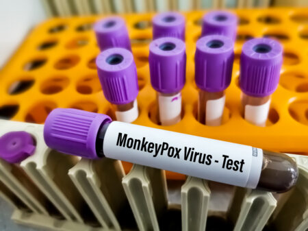 Estudo aborda transmissão de varíola dos macacos por superfície