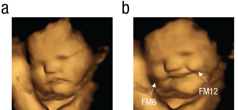 Cara de riso de um feto exposto a cenoura