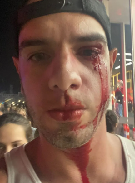 Fotógrafo é agredido no Rock in Rio