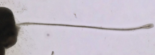O folículos capilares cresceram até 3 milímetros de comprimento