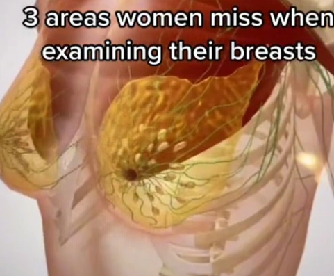 Há tecido mamário também na região da clavícula