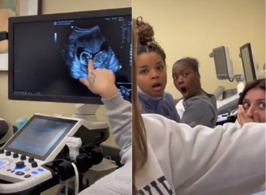 Reação de alunas “descobrindo” grávida em aula de ultrassom viraliza