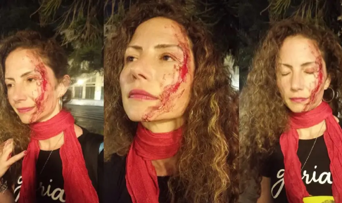 Jornalista da CNN com adesivo do Lula é agredida em Curitiba