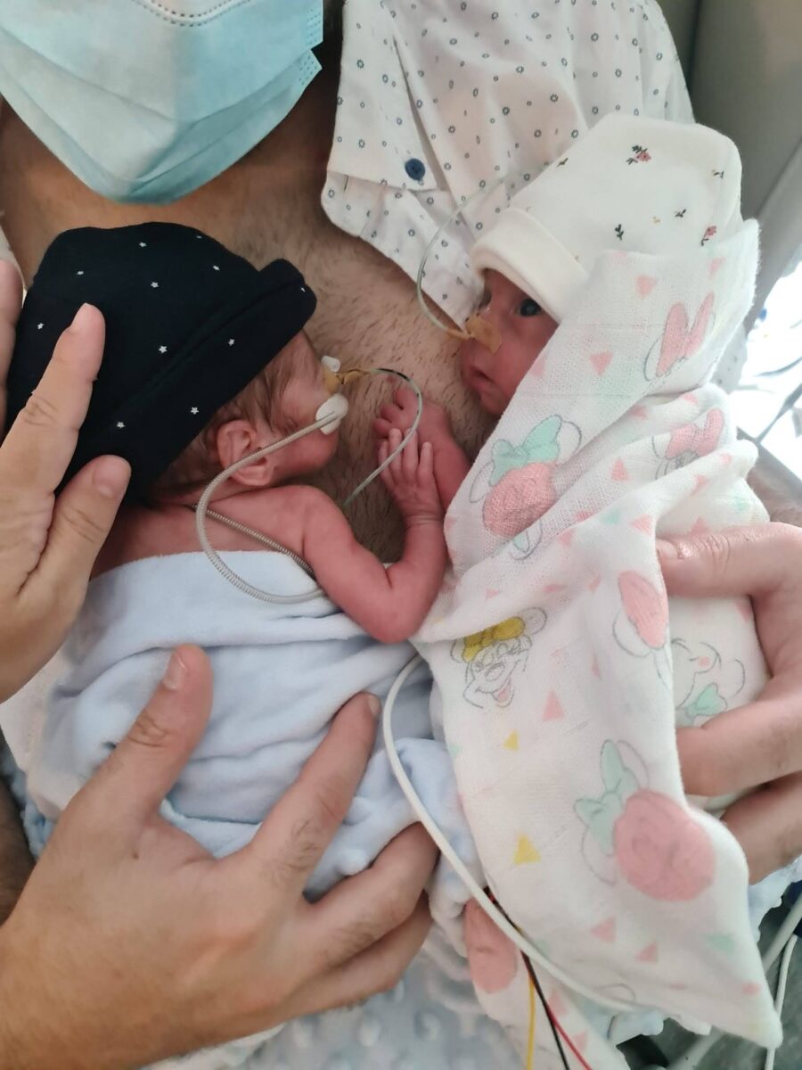 Gêmeos nascem com 9 dias de diferença na Espanha