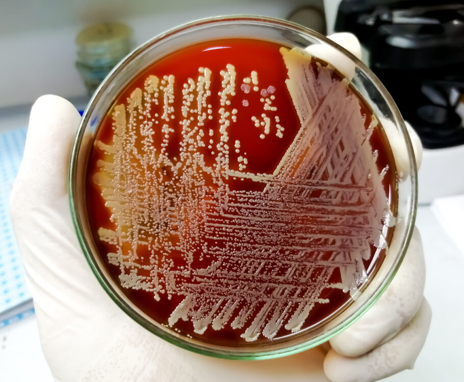 Bactérias como Staphylococcus e E. coli podem fazer morada na roupa de cama