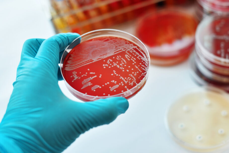 Estudo revela quais são as bactérias que mais matam no mundo