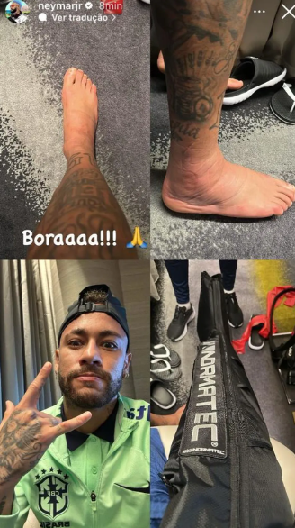 Neymar publica foto do pé inchado
