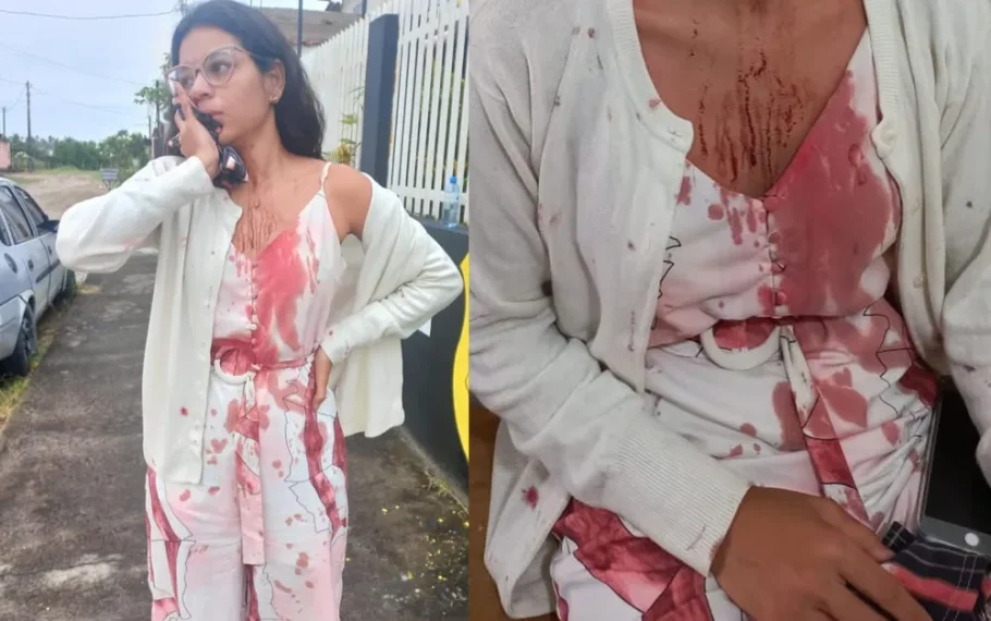  Stefani Firmo, de 23 anos, teve o rosto cortado dentro do ônibus na Bahia enquanto dormia