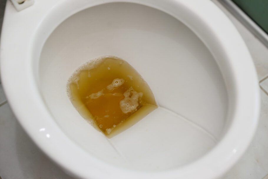 Principais causas de urina com cheiro forte