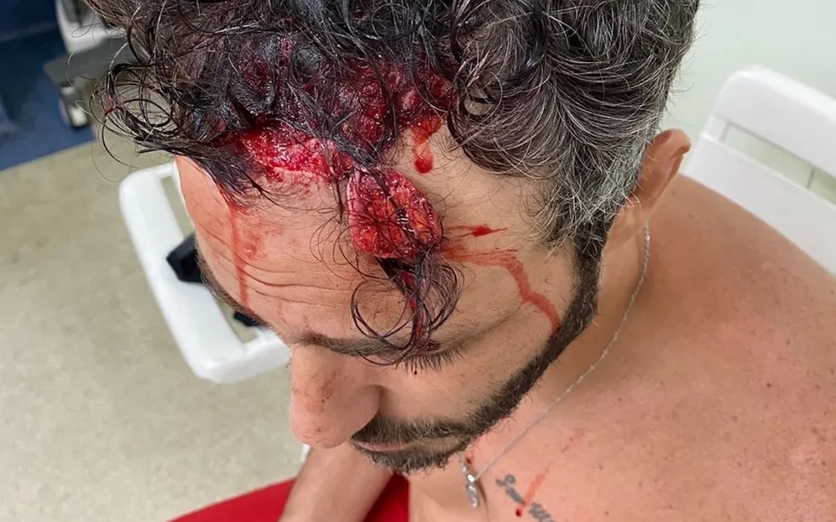 O ferimento grave de Thiago Rodrigues