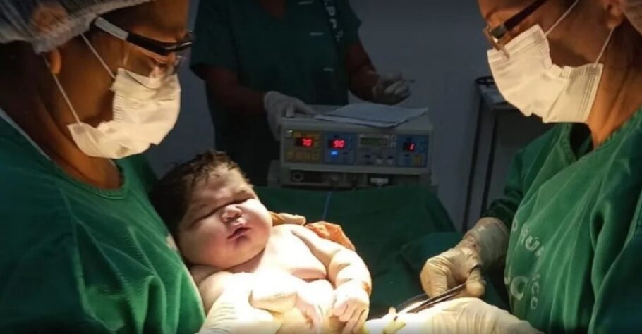 Bebê gigante nasce pesando 7 kg no Amazonas