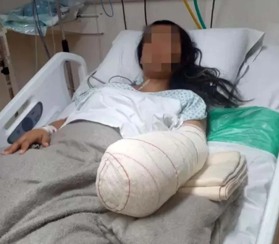  Mulher teve braço amputado após o parto, no Rio de Janeiro