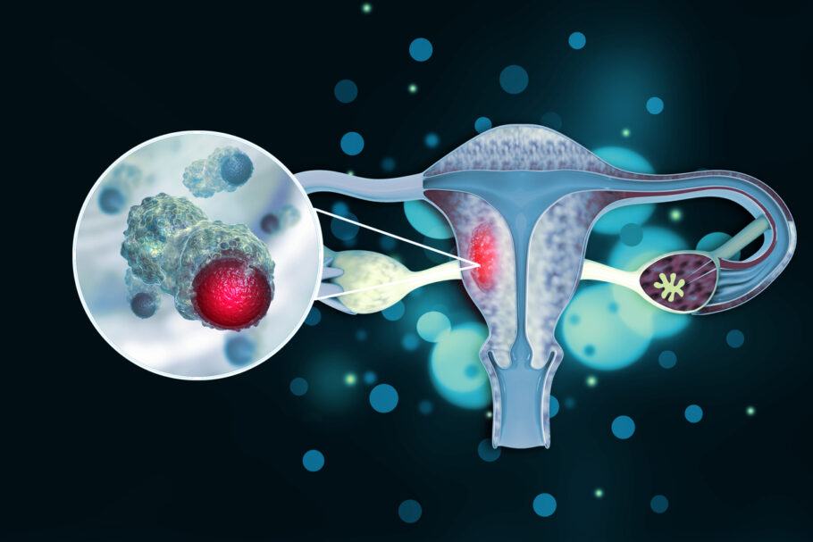  90% dos casos de câncer de colo de útero estão relacionados à incidência de HPV