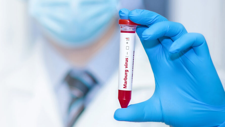A confirmação do vírus Marburg é feita por meio de exames específicos, que incluem o RT-PCR