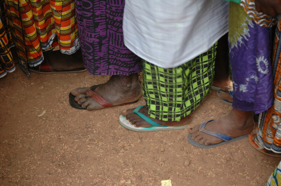 Doença misteriosa que provoca diarreia mata 20 pessoas na Costa do Marfim