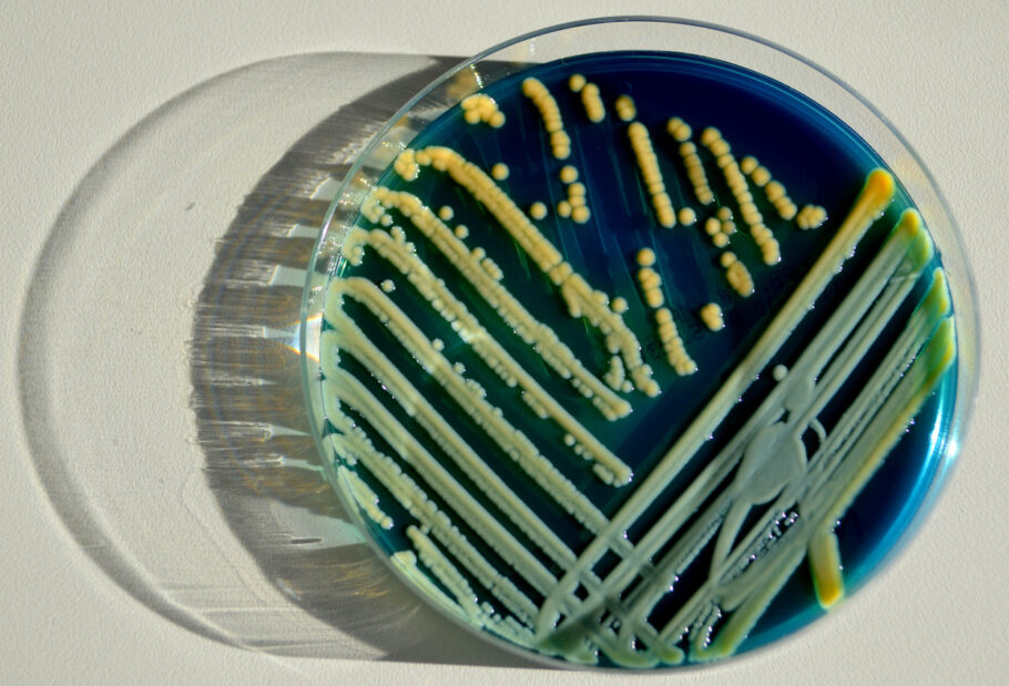 Bacteria Klebsiella pneumonia