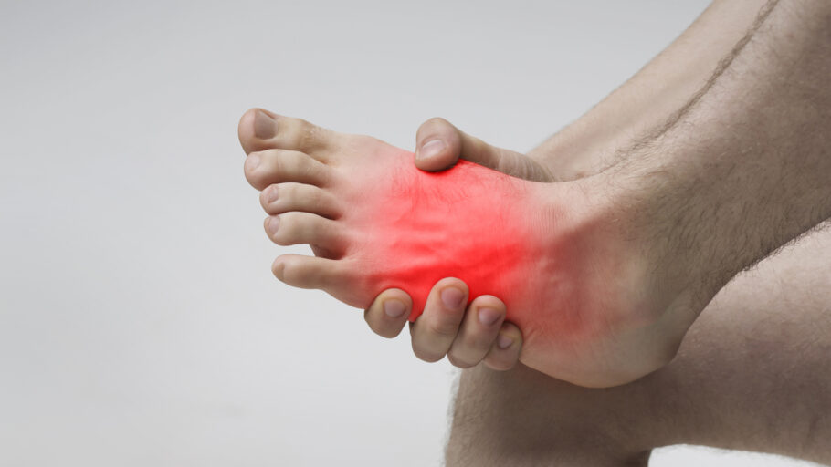 Sinal de colesterol pode ser observado no pé