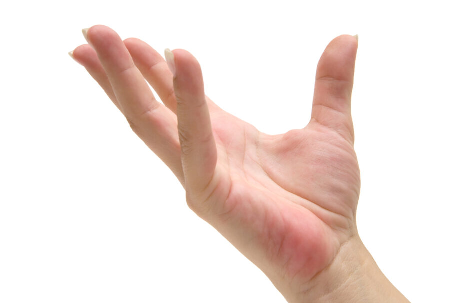 Sinais nas mãos indicam doença hepática gordurosa