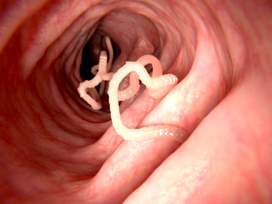 Tênia no intestino humano