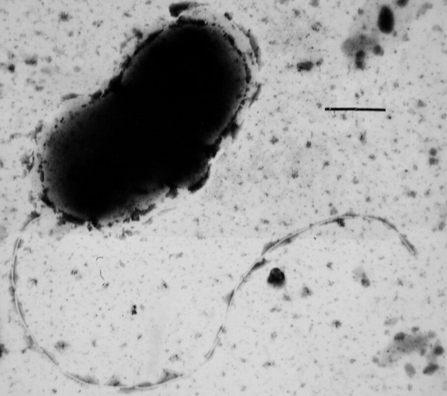 Cientistas descobrem bactéria intestinal ligada a Parkinson