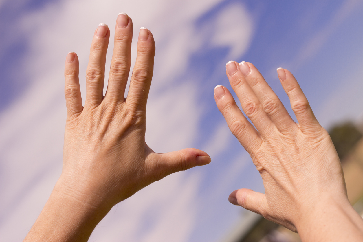 Uma simples observação dos dedos pode ajudar a diagnosticar o câncer em seu estágio inicial – iStock/Getty Images