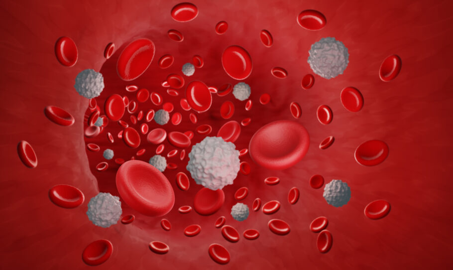 Câncer no sangue é um termo [utilizado para se referir à uma categoria de doenças onco-hematológicas que atingem o sangue, a medula óssea e o sistema linfático