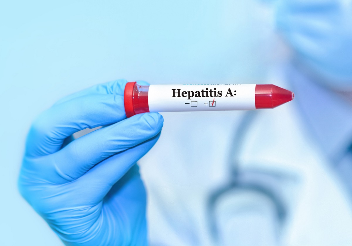Diagnósticos de hepatite A disparam no Brasil em 2023