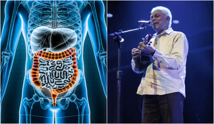 GIST é um tipo de tumor que pode começar em qualquer lugar no trato gastrointestinal