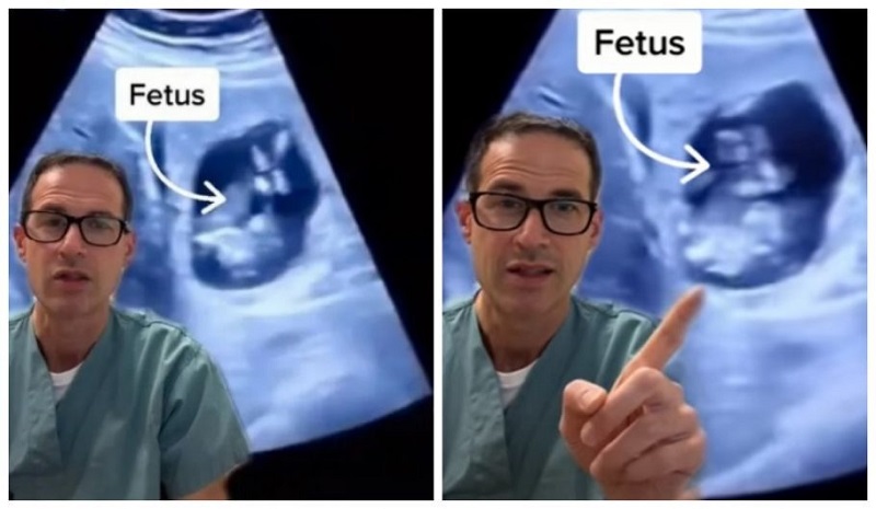 Gravidez ectópica ocorre quando o óvulo fertilizado, em vez de ser implantado na cavidade uterina, acaba em outro lugar – iStock/Getty Images